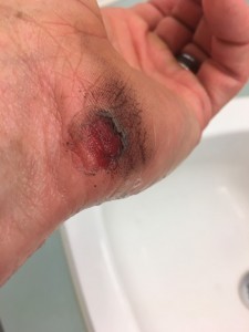 The Good That Comes From Crashing Your Bike