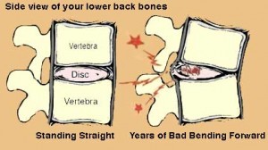 How I Fixed My Own Back